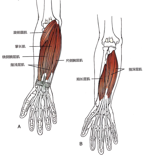 手麻也许是旋前圆肌综合征!与腕管综合征,神经根型颈椎病有区别!