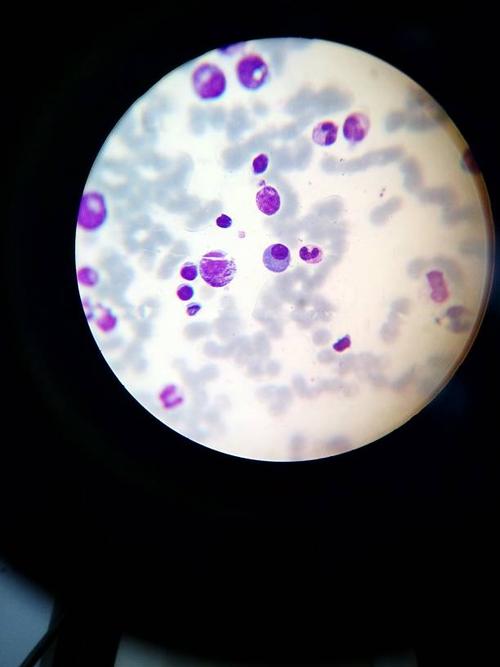 事业中央细胞核很圆,细胞质蓝色的,是浆细胞吗