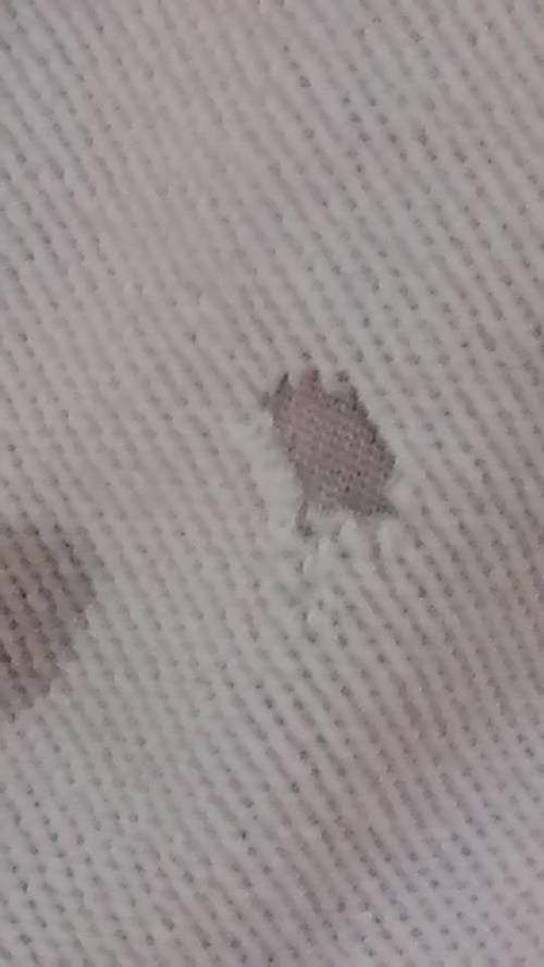 衣服这样是被虫咬了吗