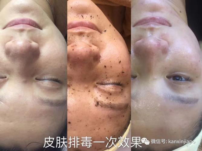 必看可以真正为你解决皮肤问题的文章