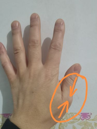 除了耳穴康复锻炼之外,在手的大拇指背侧上下推按,一次三分钟,一日