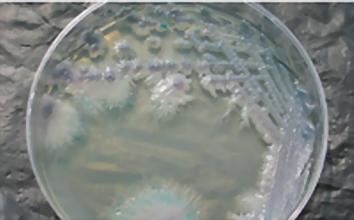  p>热带假丝酵母(candida tropicalis)即 a target="_blank" href="