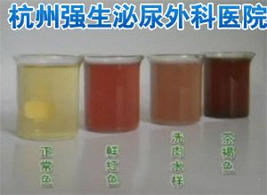 早上起床小便尿血