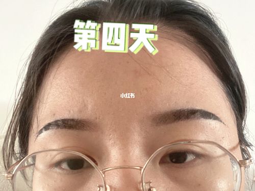 纹眉后第四天,结痂开始脱落_纹眉_眉毛_上色_美妆_医