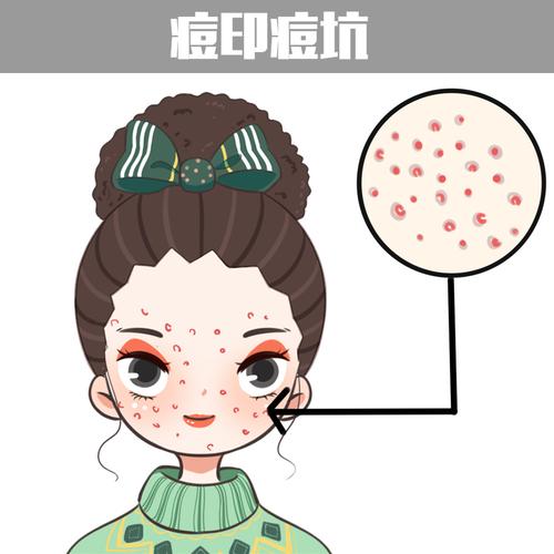 八大肌肤问题|插画|艺术插画|没事画画哦 - 原创作品