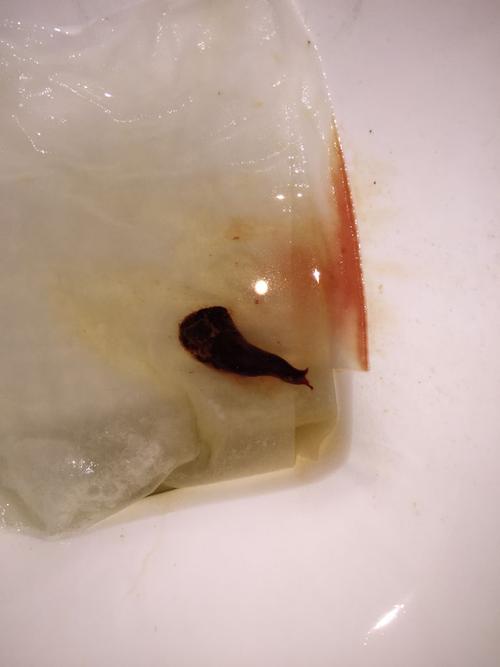 经期后20天可能流产吗?