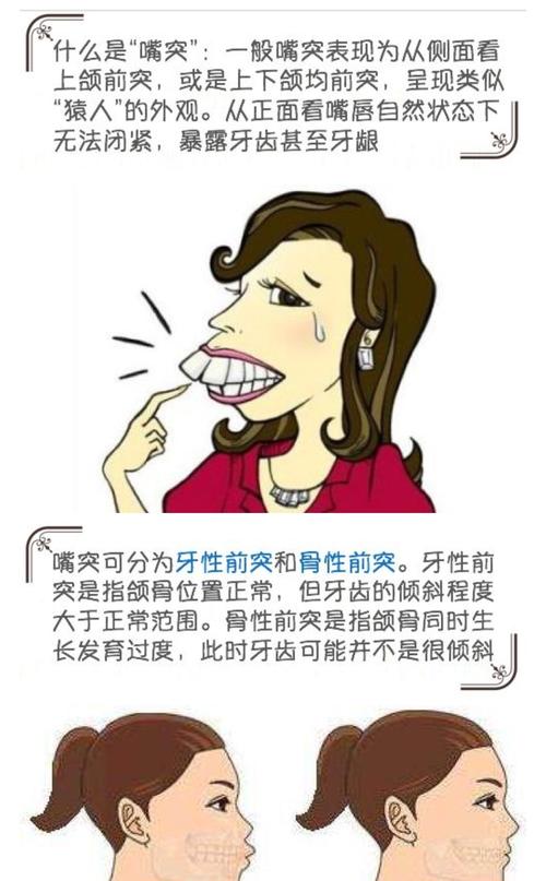 "龅牙妹"的逆袭全攻略