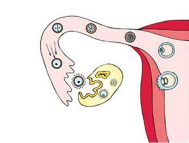 黄体破裂是什么原因导致的?