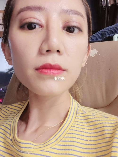 做双眼皮第7天,今天拆线了,拆线也挺疼,眼泪直流,感觉做的宽吗?