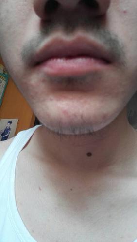 我唇毛特别重,快18了,以前都是隔一段时间用剪刀剪,但