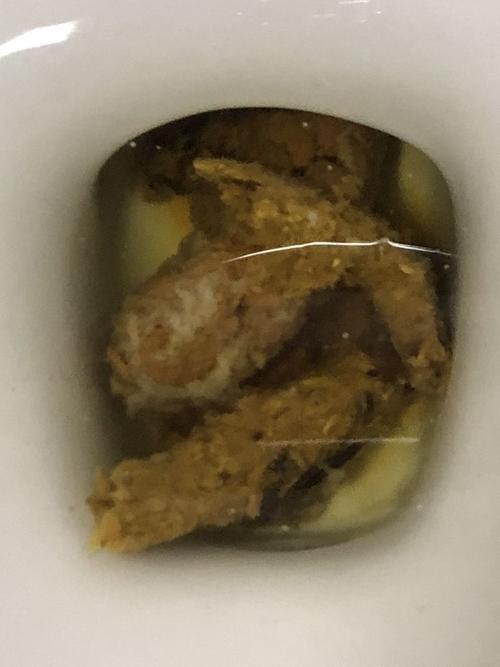 大便里白色条的是什么玩意这个是虫吗