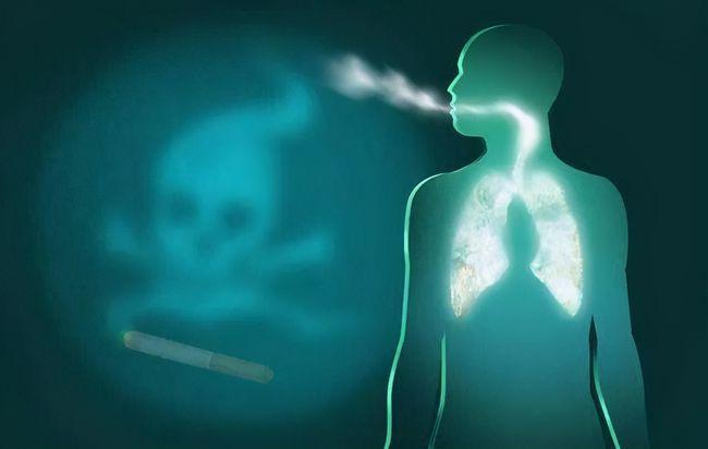 得了肺癌还能活多久?有的人不治疗也能活过5年,和这4个因素有关