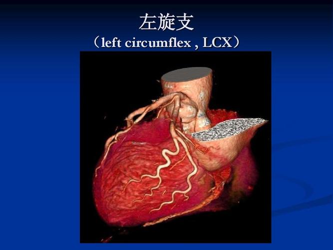 左旋支 (left circumflex   lcx)