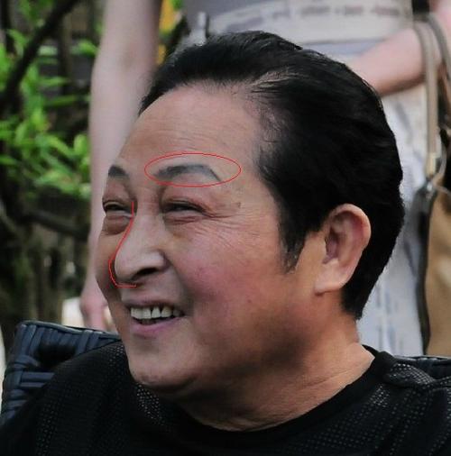 你有"福祸并至"的面相吗_薄嘴唇女人面相命运_原来也存在"福祸并至"的