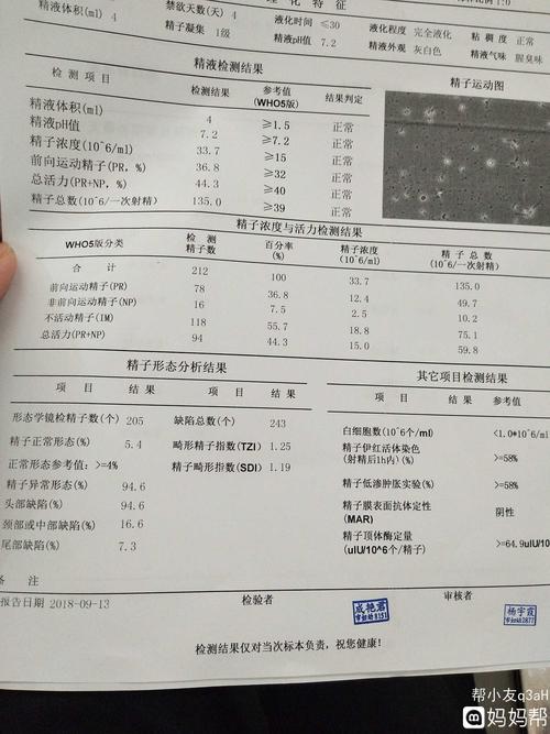 帮我看下精子浓度与活力检测报告