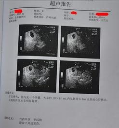 怀孕35周了,b超偏小有一个月 怀孕35周b超家庭关系