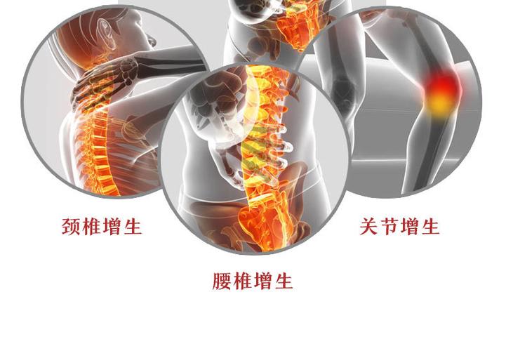 骨质增生型_07