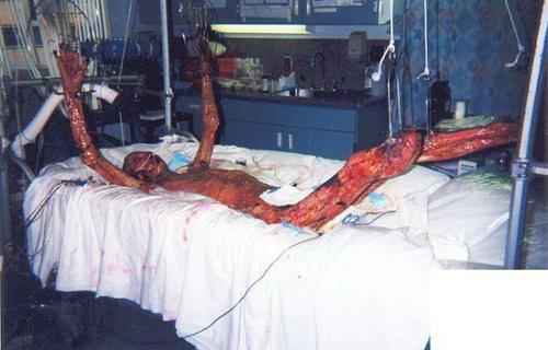 83天的燃烧 (05-02-2011一逸)  下午看日本nhk有关茨城县东海村jco