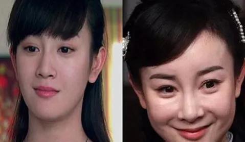 那些娱乐圈整容失败的女明星,一步步从貌美走到如花