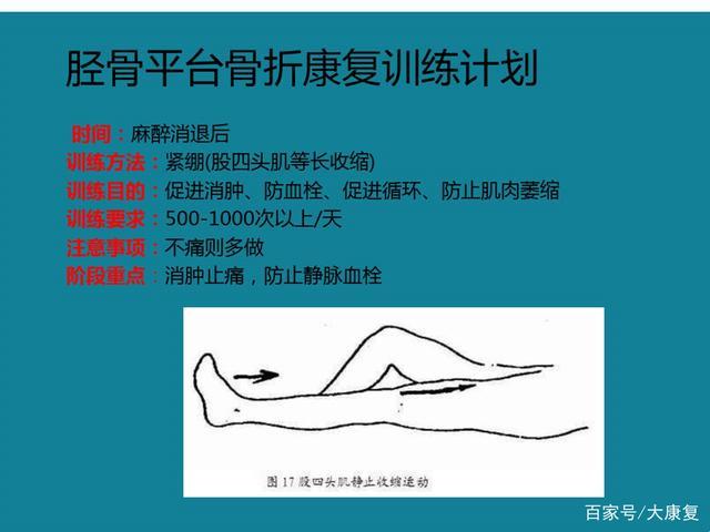 胫骨平台骨折术后康复训练计划