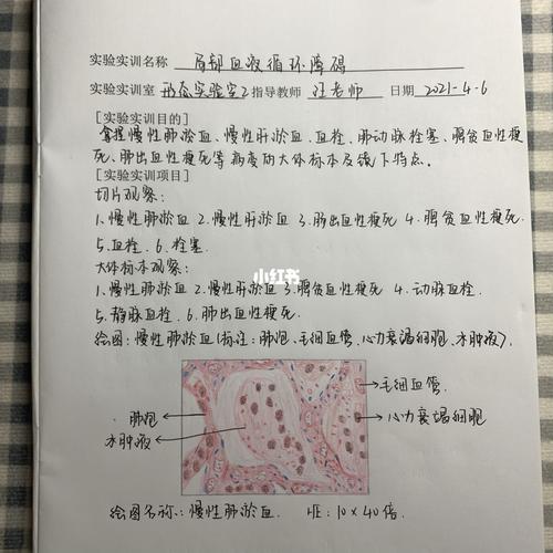 慢性肺淤血绘图_病理学实验报告_医疗健康_医疗健康