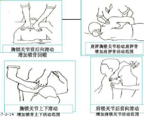 [转载]关节松动术