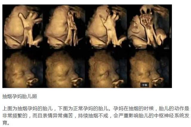 孕妈烟不离手,胎儿在四维彩超中的模样,让