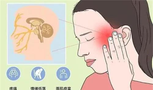 三叉神经痛的常见症状看看你中了几条