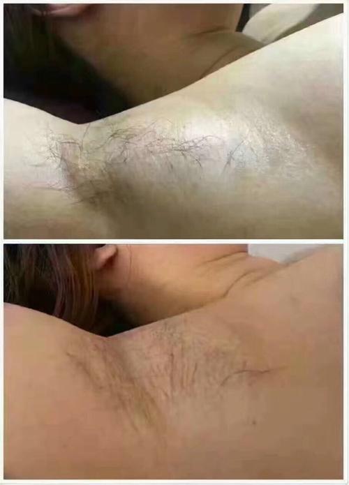 减肥99元三次  2.tbs塑形188元单次(除了手臂和腿部) 3.