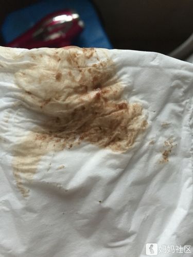 月经还没有来,有姨妈感,今天又流褐色分泌物了,怎么回事[哭][哭][哭]