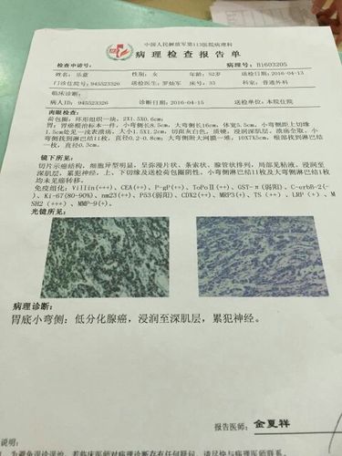 这是我妈手术切掉的胃癌化验单,医生说要化疗,不是心疼钱真的不想给她
