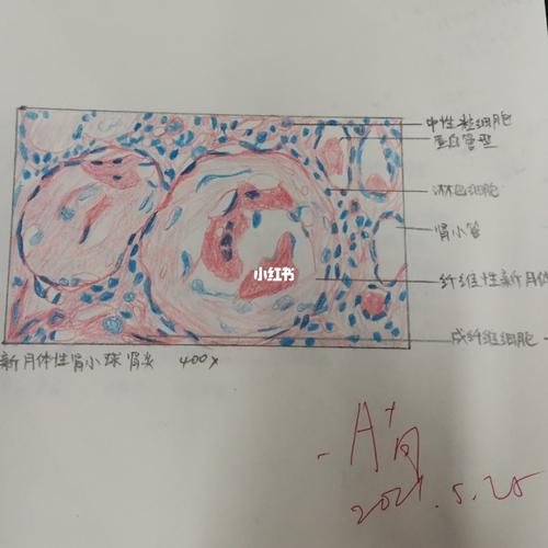 病理红蓝铅笔绘图