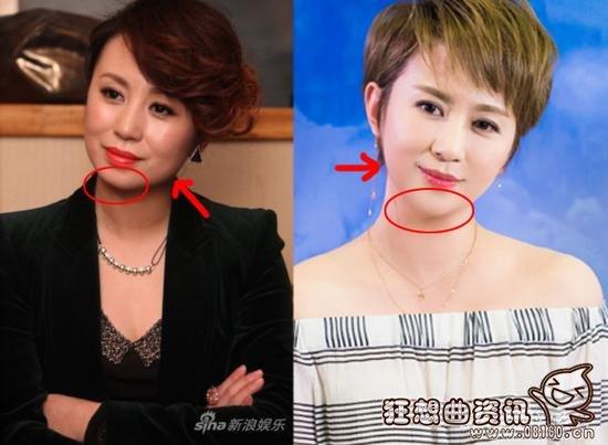 马丽这几年变化也太大了组图,马丽有没有整过容?