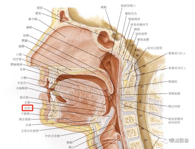 ct示:会厌明显肿胀,增粗,密度减低,咽腔狭窄男,50岁,3天发热,咽痛