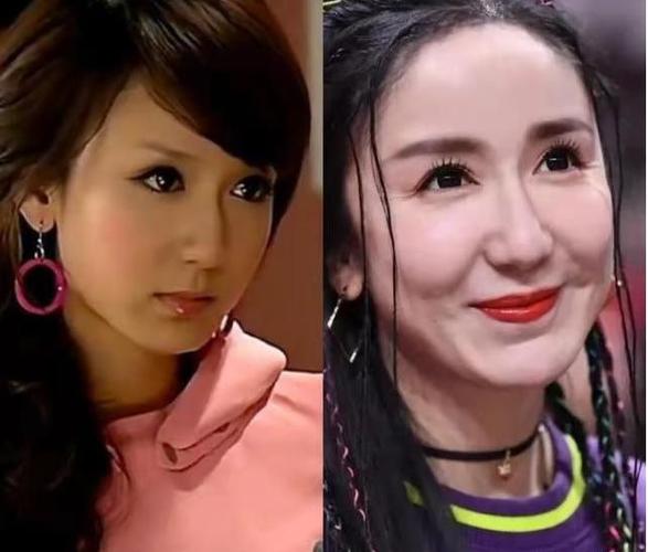 明星整容翻车现场吓跑未婚夫吓跑粉丝最后一个68岁还在整容