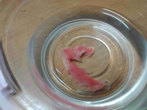 这是孕囊还是子宫内膜?