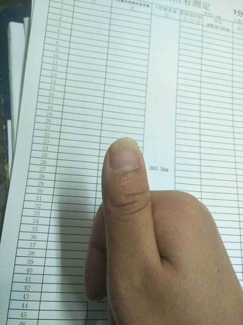 大拇指指甲盖前三分之一空了…后来自己慢慢又长好了,这过了几个月又