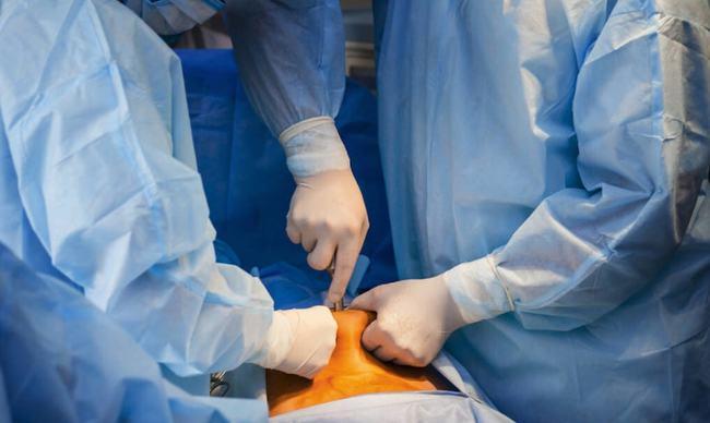 好好的怎么就突然鞘膜积液了腹股沟管鞘膜积液睾丸疾病腹膜附睾