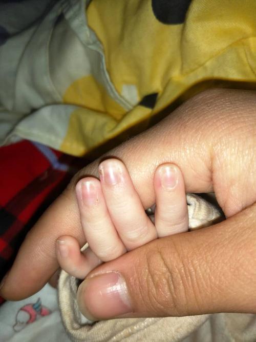 刚出生15天的小孩邻居说指甲发紫