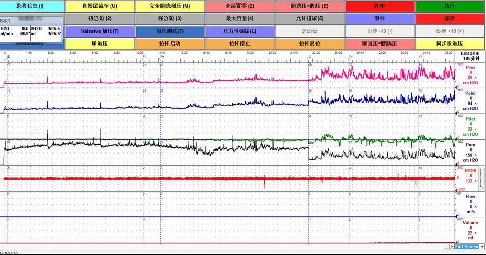 患者尿动力学检查结果