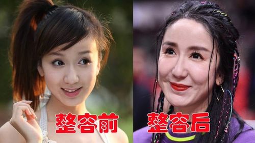 整容失败的女星,王丽坤素颜女神彻底整垮,张檬取出假体颜值回春