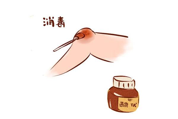 伤口怎么处理