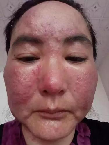 【激素脸】老司机带你上车,终点是美丽的