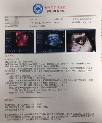 平均每生700个婴儿中就有一个患唇腭裂