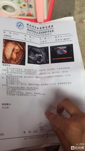 妈妈们帮我看一下男孩女孩,三胎