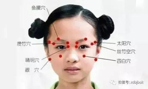 【康复馆】针药结合治疗动眼神经麻痹