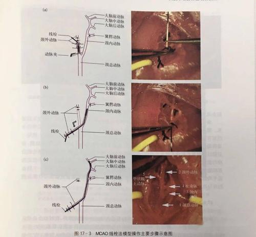 技术干货 | mcao造模方法及如何提高成功率_动脉