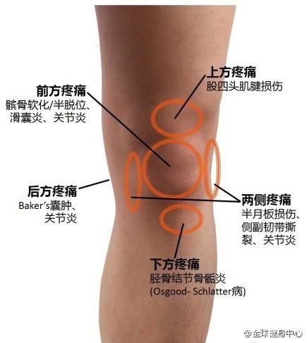 一张图教会你初步判断【膝关节疼痛原因】.好东西,要
