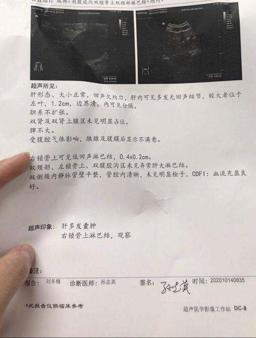 新发现右锁骨上淋巴结,是什么情况?-肺癌康复圈-觅健