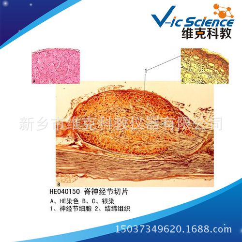 脊神经节切片 组织学与胚胎学 神经系统 生物切片标本 显微镜玻片